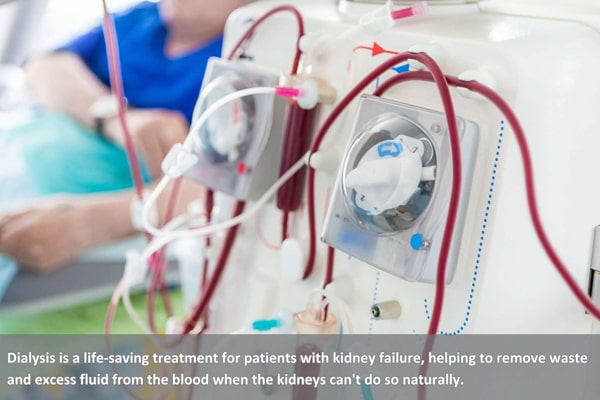 Interim Dialysis