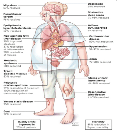Benefits-of-bariatric-surgery