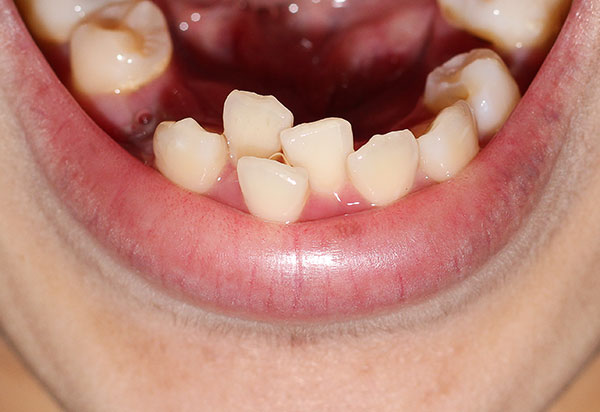 Orthodontics1