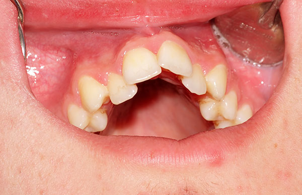 Orthodontics2