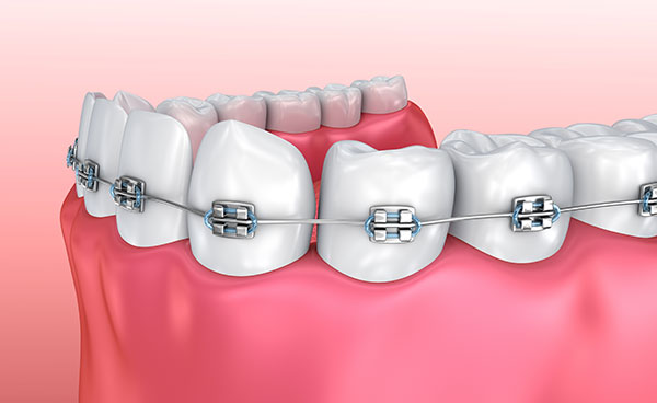 Orthodontics3