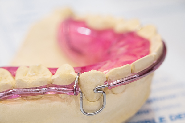 Orthodontics4