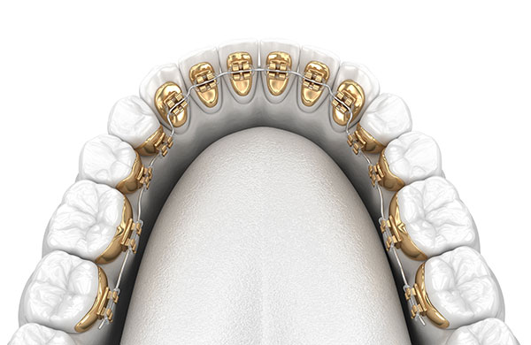 Orthodontics6