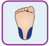 heel-prick
