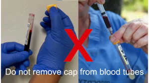 Do not remove caps from tubes 20240628 FG - copy2